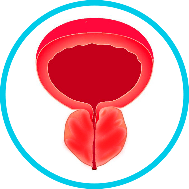 Příznaky prostatitidy